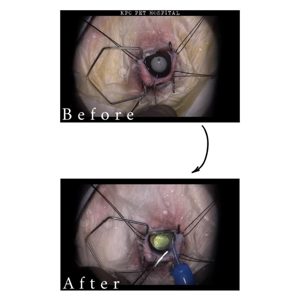 Cataract surgery — before and after